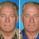 Image for article titled Guess which of these identical twins is the smoker